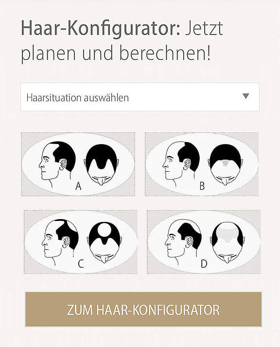 Konfigurator Haartransplantation, info Ästhetik