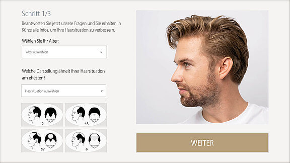 Konfigurator Haartransplantation, info Ästhetik