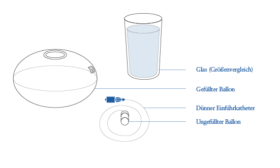 Graphik Magenballon, info Ästhetik